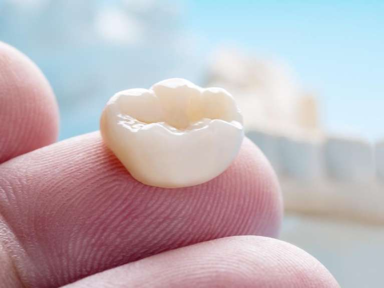 A hand holding a dental crown