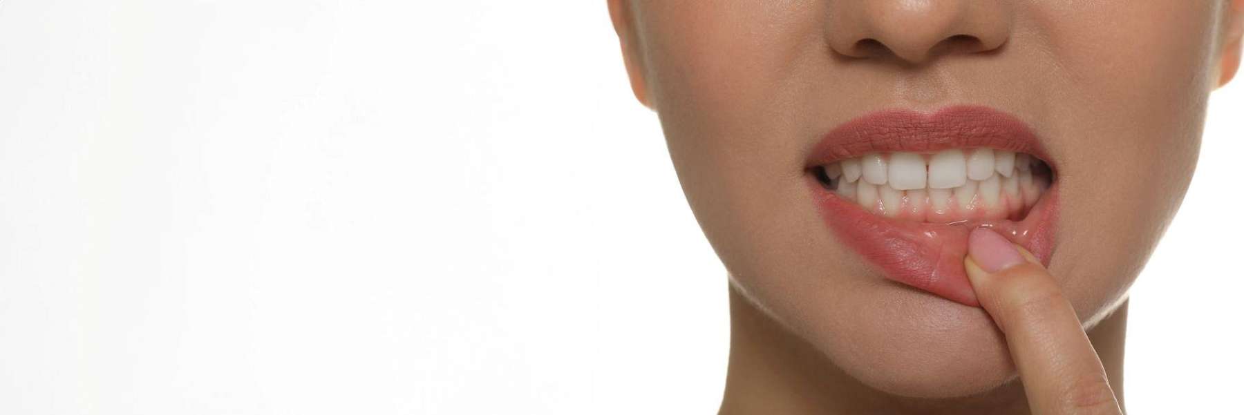 A woman pulling down her lip to show her teeth